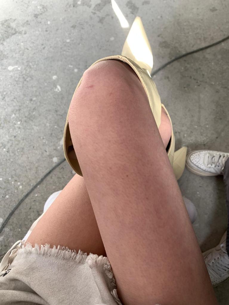 李嫣拍攝〈也不是第一次死了〉MV 遇寒流 雙腳發紫、差點失溫